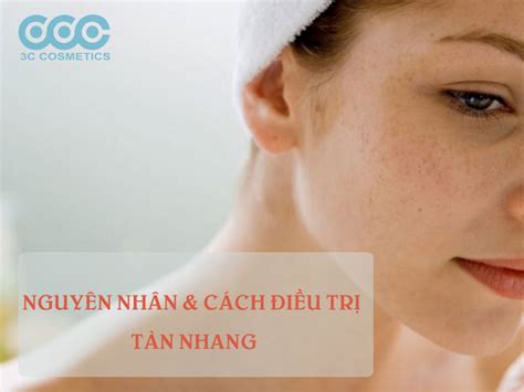 cach dieu tri tan nhang  shop