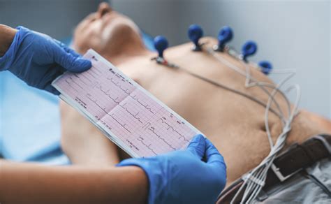 O'que É Eletrocardiograma - O que é eletrocardiograma e para o que ele serve? - Consultare
