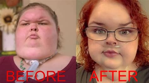 1000 Lb Sisters: All About Tammy Slaton's Miraculous Body ...