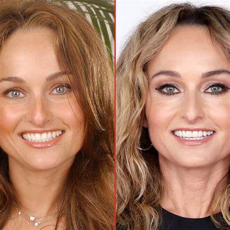 Giada De Laurentiis Implant Chíche