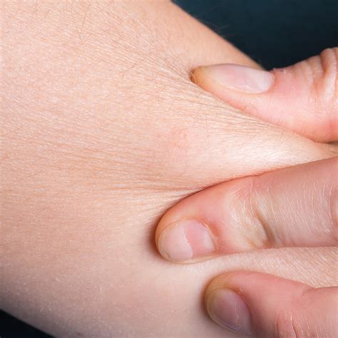 Bid Goodbye to Winter Dry Skin - Juicy Chemistry