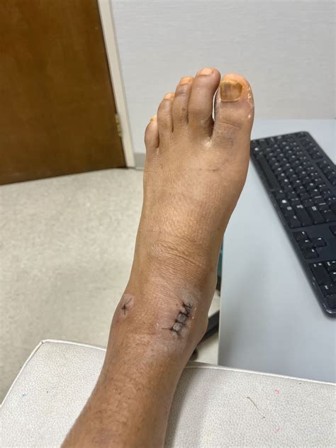 LOUISVILLE ORTHOPAEDIC CLINIC - New Albany IN - Hours, Directions