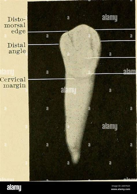 Principles and practice of operative dentistry . Fig. 28.—Superior ...