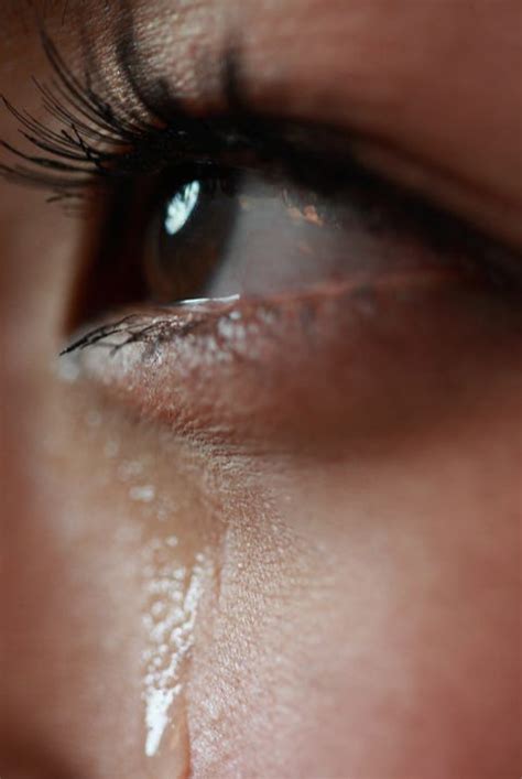 What Your Eyes Say About Your Health - Why Do I Have Red Eyes?