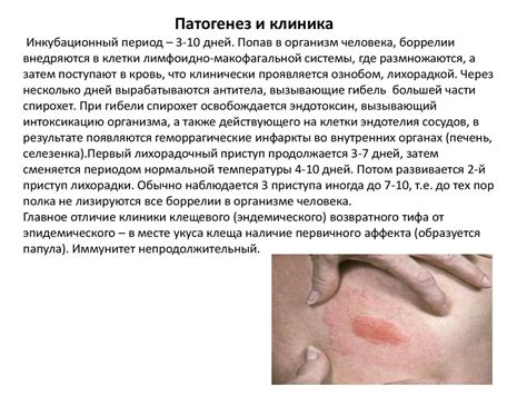 Боррелиозы Возвратный тиф - презентация онлайн