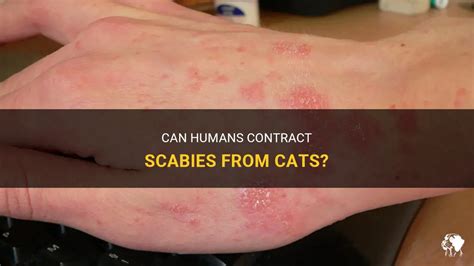 Can Humans Contract Scabies From Cats? | PetShun