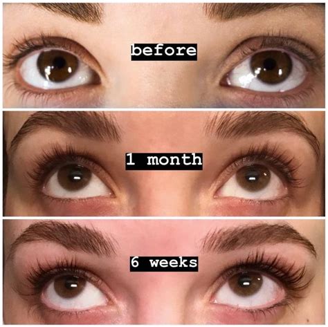Castor Oil For Eyelash Growth Before And After
