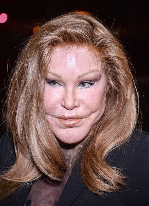 ‘Catwoman’ Jocelyn Wildenstein Denies Cosmetic Surgery Interventions in Her Life Citing Her ...