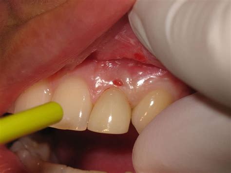 Gum Disease Can Kill More Than Your Smile | Craig V. Smith DDS FAGD