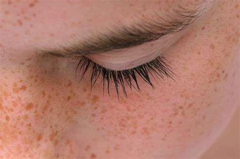 Dark Spot Remover Breakdown | 100% PURE