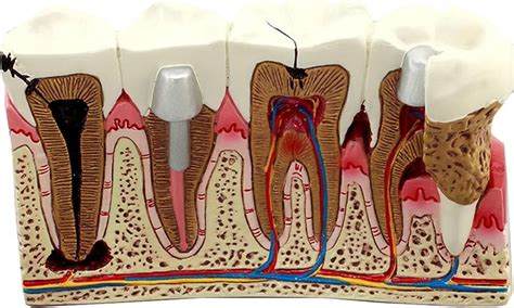 tooth labeling diagram quizlet