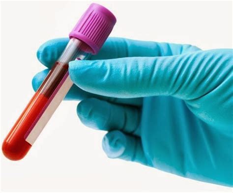 O Que Ureia No Sangue - SAÚDE CANAL DA VIDA: Saiba mais sobre o exame de ureia no sangue
