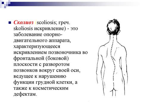 Лечебная физкультура (ЛФК) при сколиозе - презентация онлайн