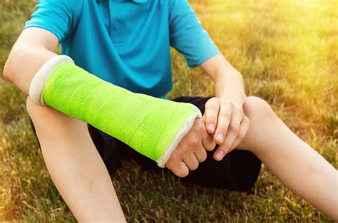2,300+ Broken Arm Cast Stock Photos, Pictures & Royalty-Free Images ...