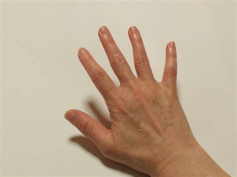 手の甲黄色いのは病気？黄疸との見分け方を解説 | 湘南カイロ茅ヶ崎整体院