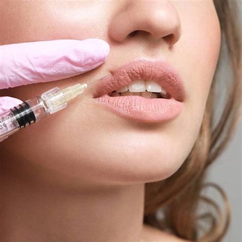 Where to Inject Botox® for Lip Flip - IAPAM