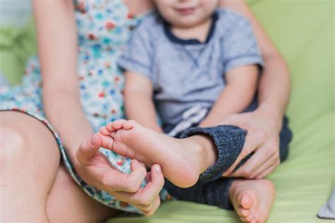 foot deformities commonly   babies  cerebral palsy