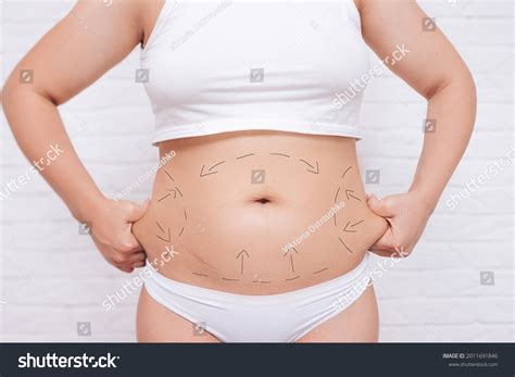 1,229 Abdominal contouring Images, Stock Photos & Vectors | Shutterstock