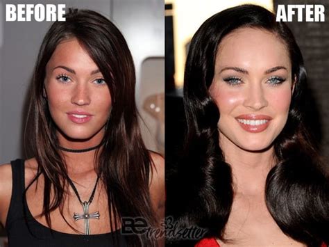 Megan Fox Before And After