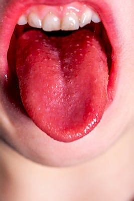 What Does A Healthy Tongue Look Like