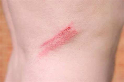 abrasion test stock  pictures royalty  images istock