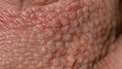 premium photo  close    persons skin  red bumps