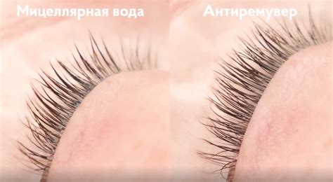 Расскажем о ремувер для ресниц что это такое