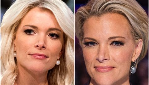 Megyn Kelly Nose Job Bad