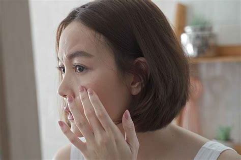Panu di Wajah, Ini Penyebab dan Cara Mengatasinya - Alodokter