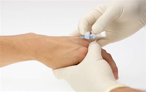 Peripheral Intravenous Catheters (PIVCs) versus Long Peripheral ...