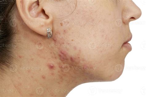 skin problem stock  images  backgrounds