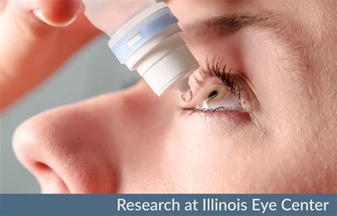 Clinical Trials at Illinois Eye Center - Illinois Eye Center