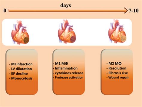 Diagram of the main features associated with MI disease MI results from ...