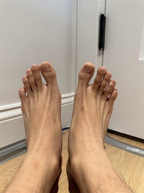 Am I developing bunions? 19M : r/bunions