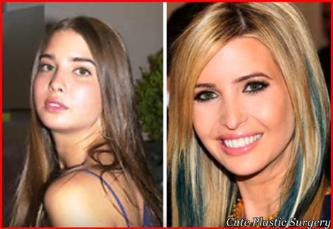 Ivanka Trump plastic surgery Pictures - Before and After - Celebrities Plastic Surgery