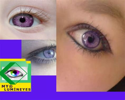 violet eyes rare eye color   medical facts