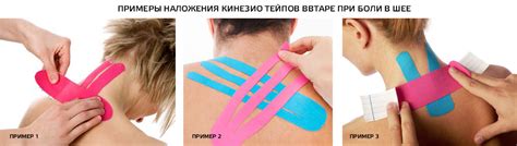 Тейпирование шеи — правила применения и отзывы о результатах