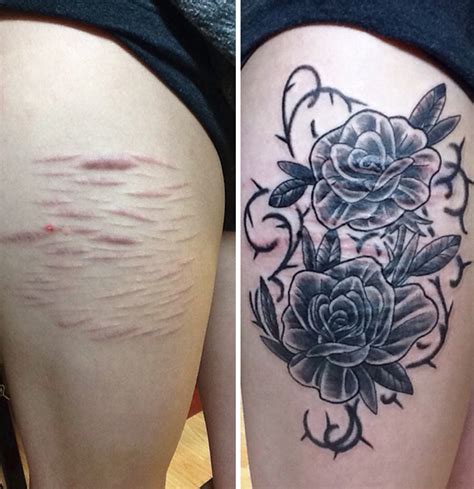 10+ Amazing Scar Cover-Up Tattoos - Part 12