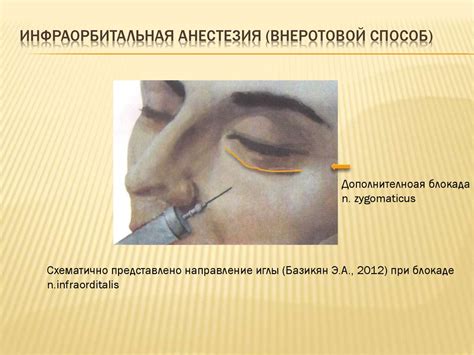 Эффективное обезболивание в косметологии - презентация онлайн