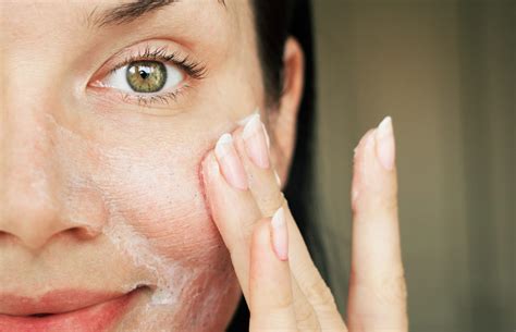 Manage Your Dry Skin in the Winter Months