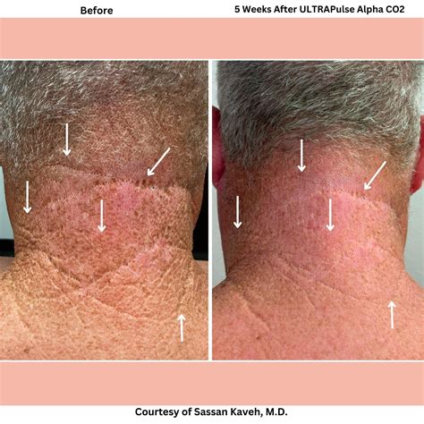 Alpha Medical Aesthetics - Medical Spa - Las Vegas, NV
