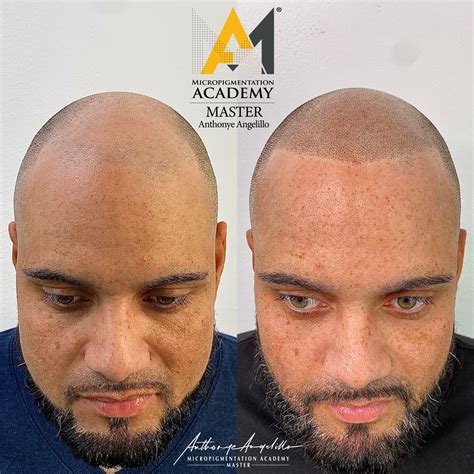 Scalp Micropigmentation Online Training Course in CT