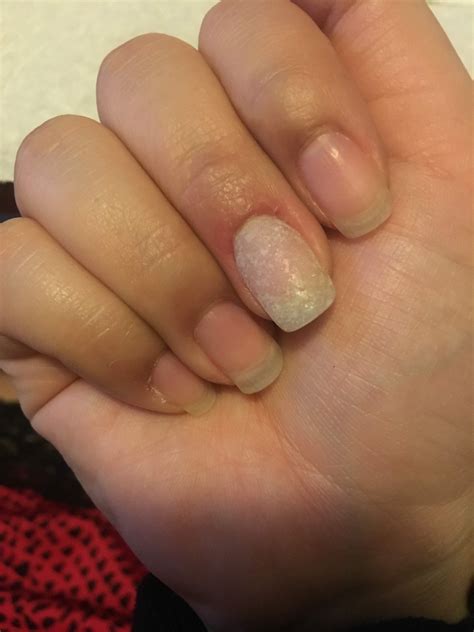 Broken nail super glue fix | Nails, Broken nails, Fix broken nail