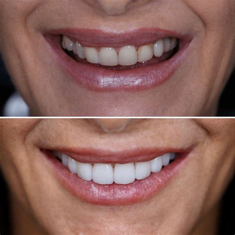 Our Work | Image Gallery | Dental Haus