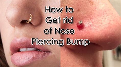 Nose Piercing Infection Bubble