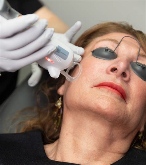 Lentigo Treatment in Fort Collins | Xanadu Med Spa