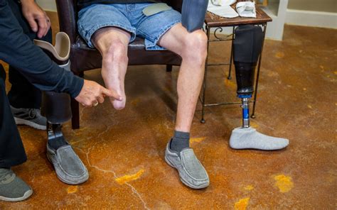 introduction   limb prosthetic  alltech prosthetics