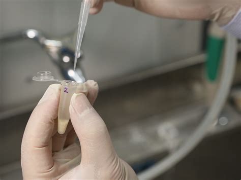 Video: Visualization of the Axonal Projection Pattern of Embryonic ... 