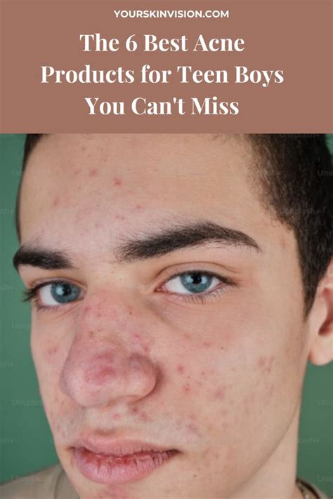 acne products  teen boys    teen acne boys