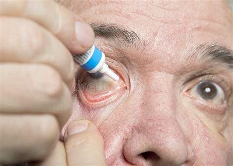 Eye disease treatment stock image. Image of health, cataracts - 87852453